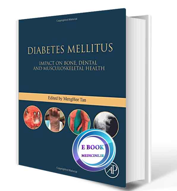 دانلود کتابDiabetes Mellitus: Impact on Bone, Dental and Musculoskeletal Health (Bones, Joints, and Hormones series) 1st 2021 (ORIGINAL PDF)